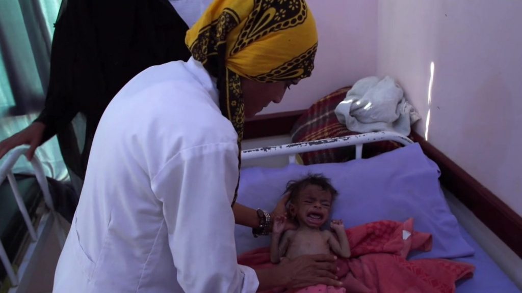 Cena de Hunger Ward. Na imagem, a enfermeira Mekkia Mahdi, uma mulher de pele amarronzada, vestindo um jaleco branco e um hijab amarelo com estampas pretas, se inclina sobre um leito hospitalar, em que uma criança muito magra chora.
