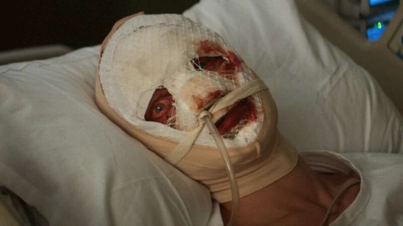 Cena do filme Cara-de-BarroNa imagem, o personagem título está com o rosto enfaixado, deitado em uma cama de hospital enquanto recebe oxigênio por aparelhos. Seus olhos e bocas estão visíveis e ensanguentados, o olho direito dele está arregalado com expressão de medo. O personagem possui pele clara e olhos claros. A fronha do travesseiro e a roupa vestida por Cara-de-Barro são brancas. 